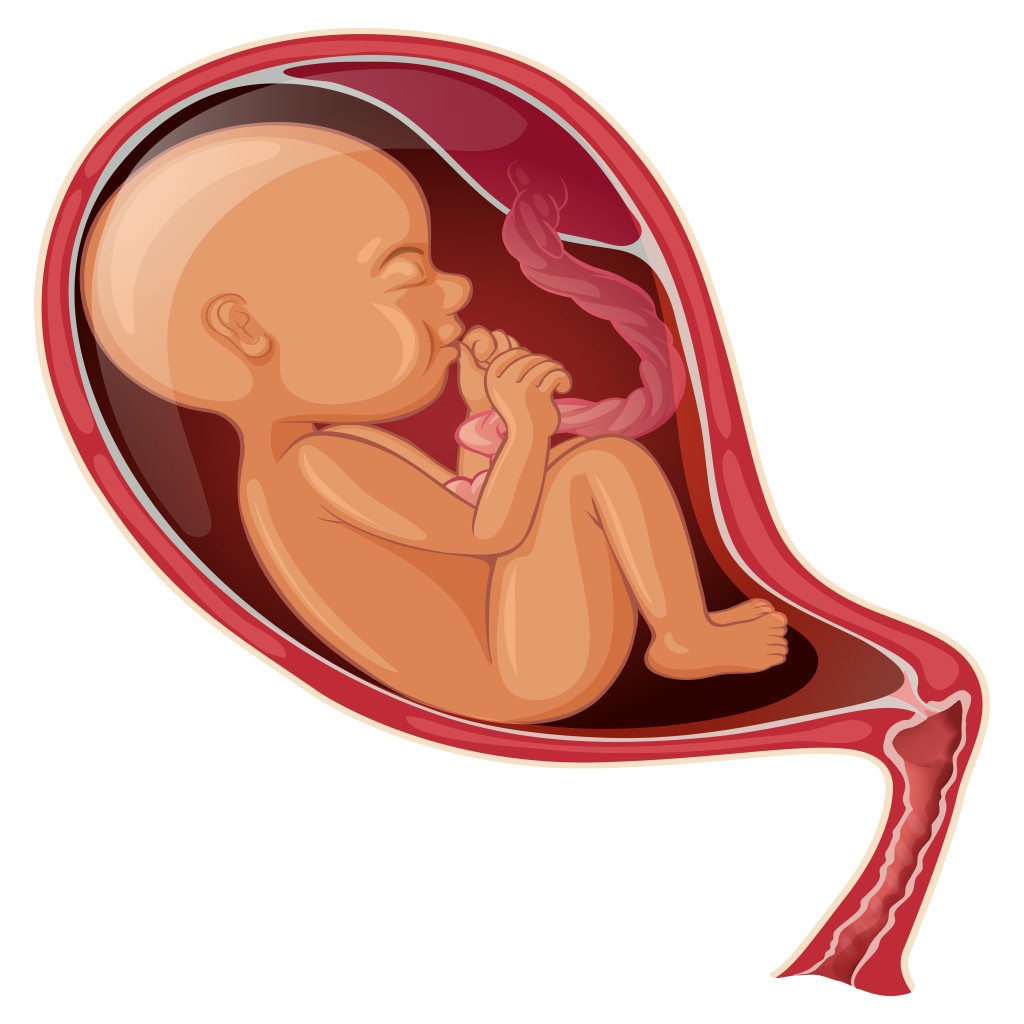 Placental Abruption